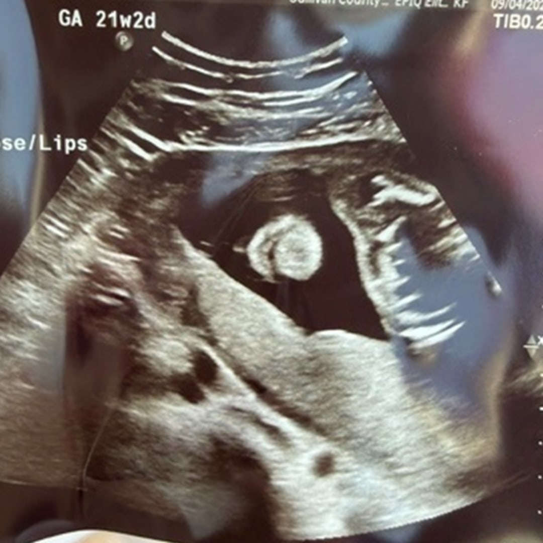 Photo shared by Madison for their Babylist baby registry.