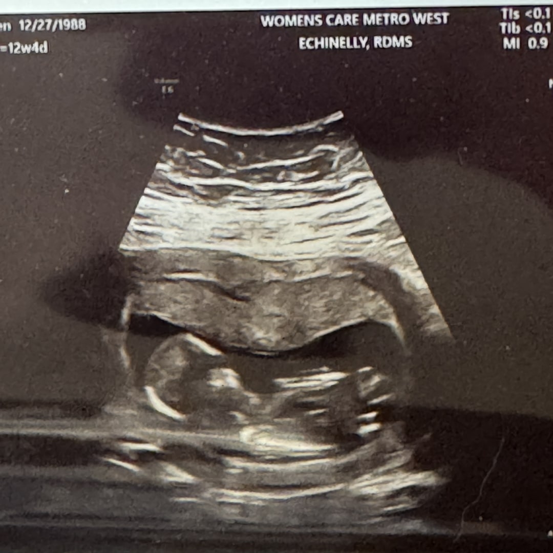 Photo shared by Lauren for their Babylist baby registry.