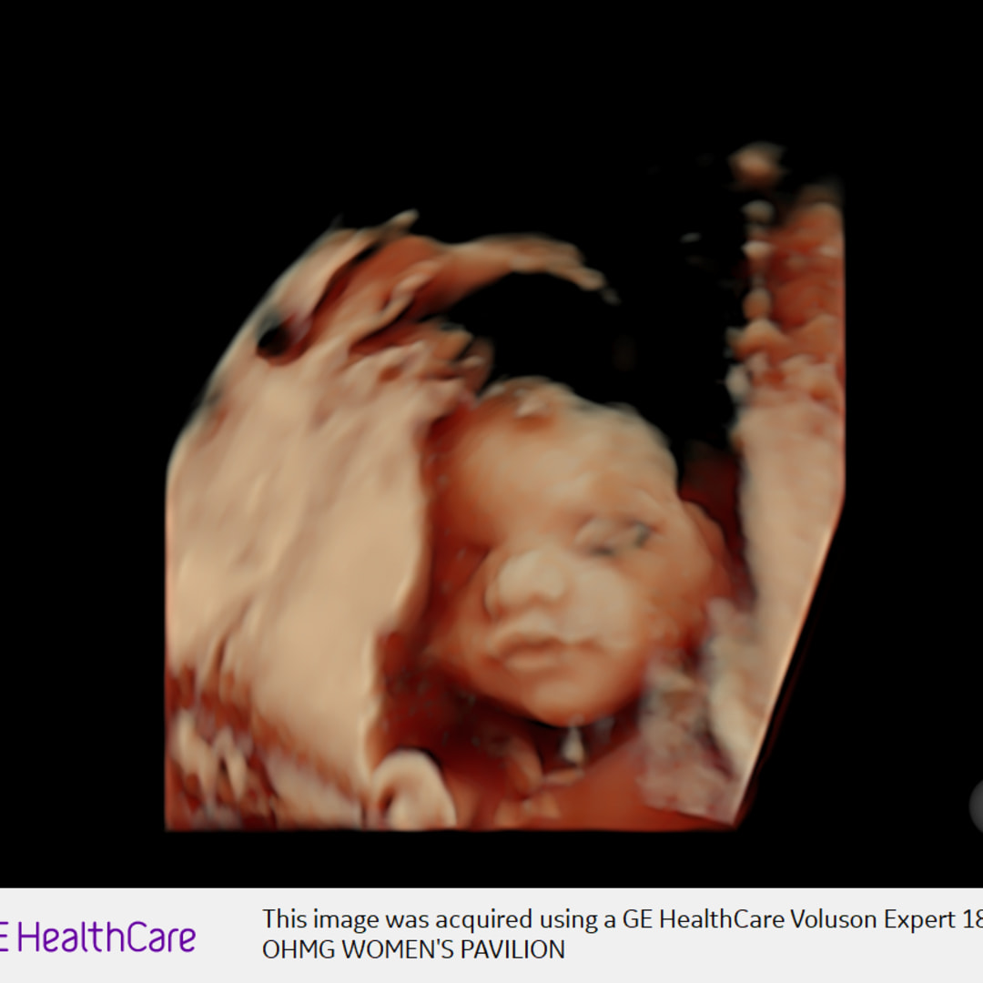 Photo shared by Elizabeth for their Babylist baby registry.