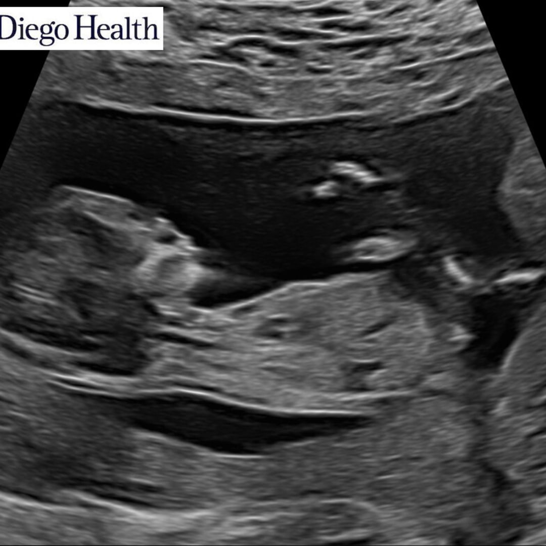 Photo shared by Lizbeth for their Babylist baby registry.