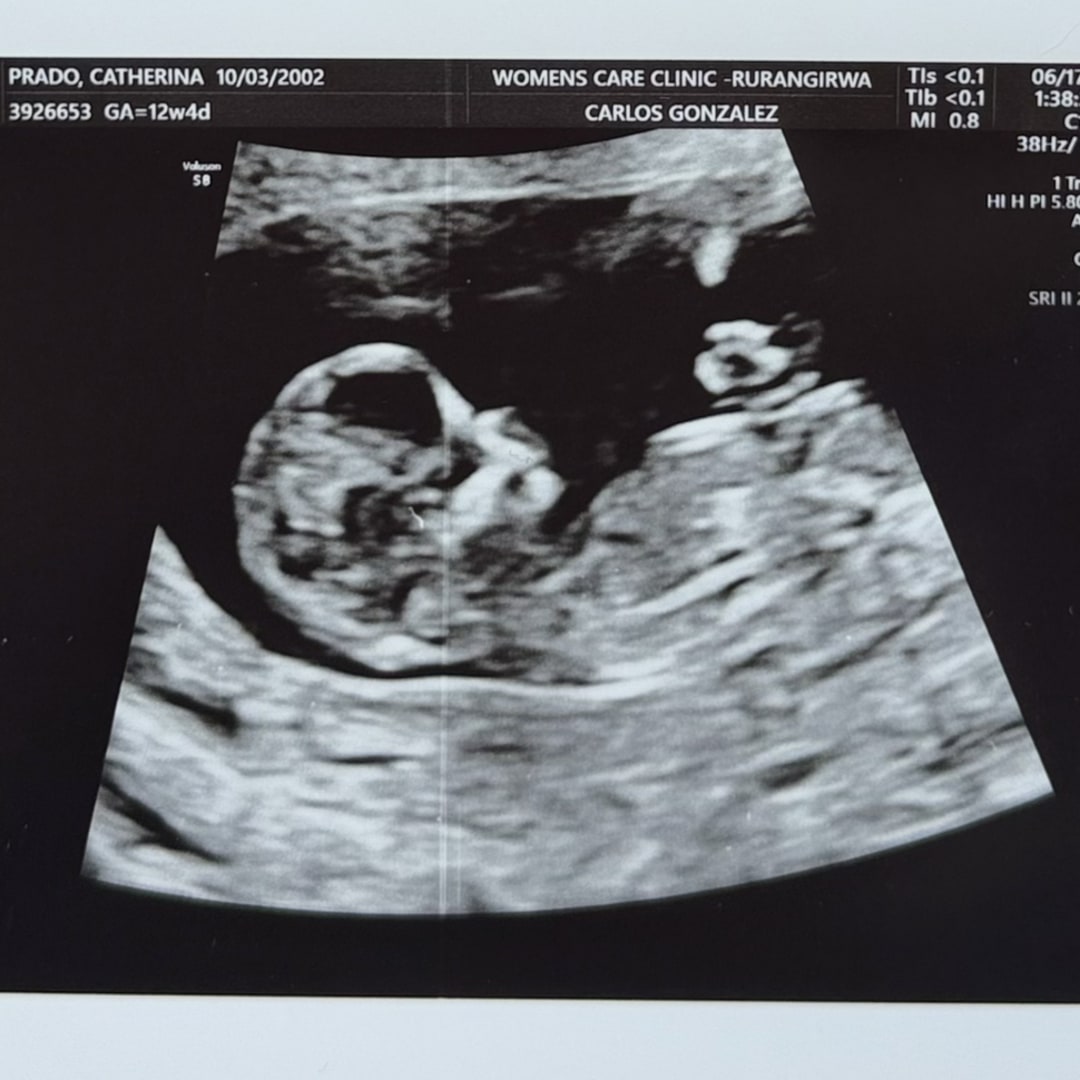 Photo shared by Catherina for their Babylist baby registry.