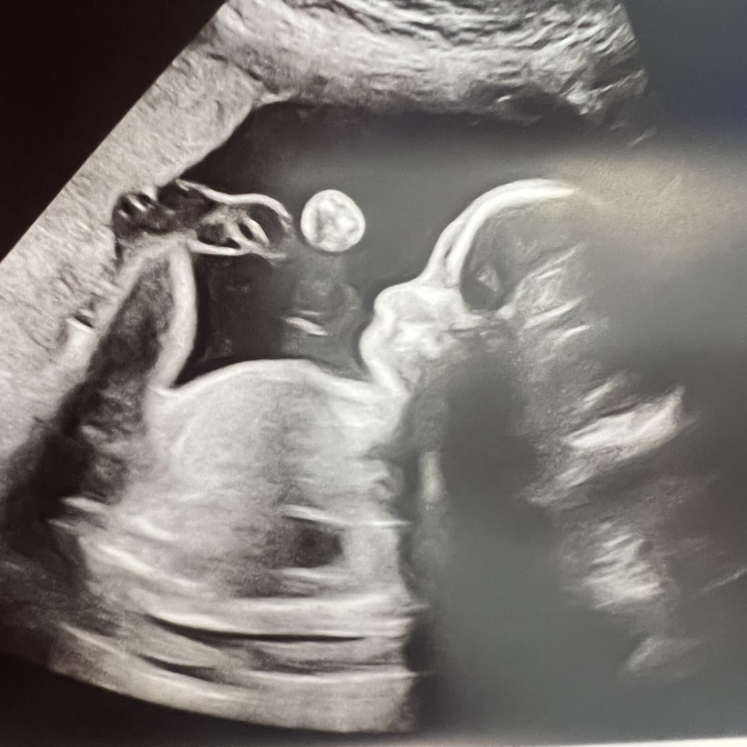 Photo shared by Leia for their Babylist baby registry.
