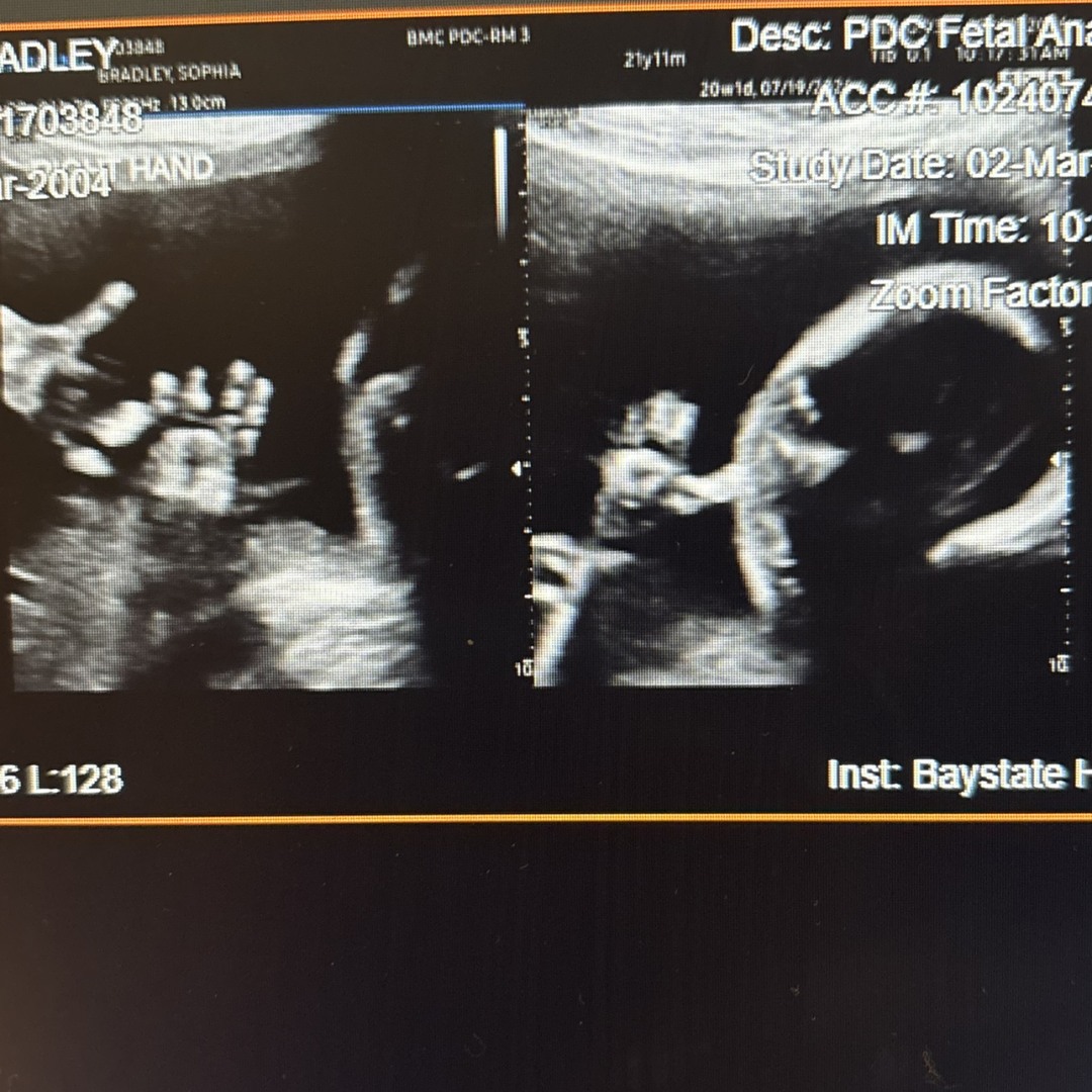 Photo shared by Sophia for their Babylist baby registry.