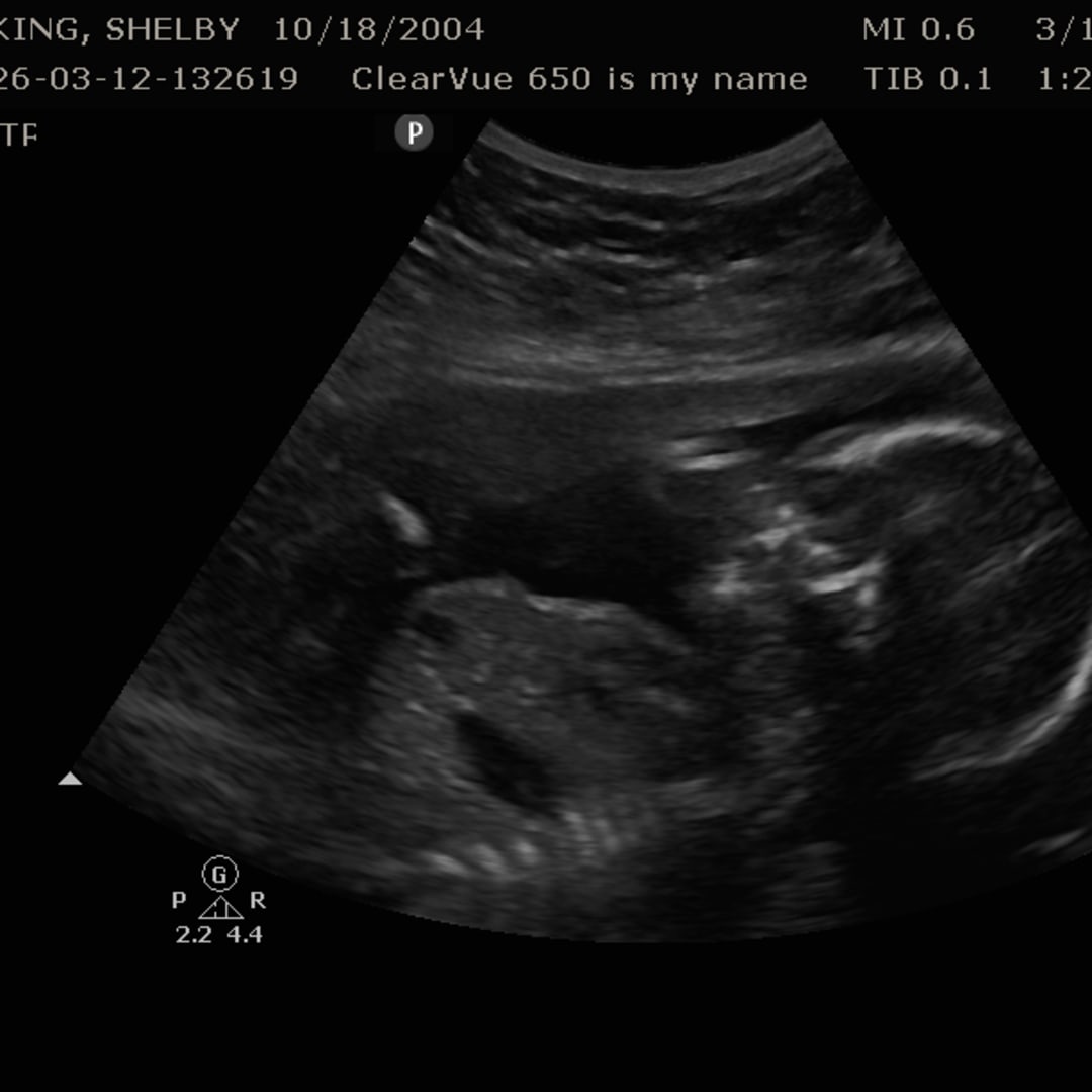 Photo shared by Shelby for their Babylist baby registry.