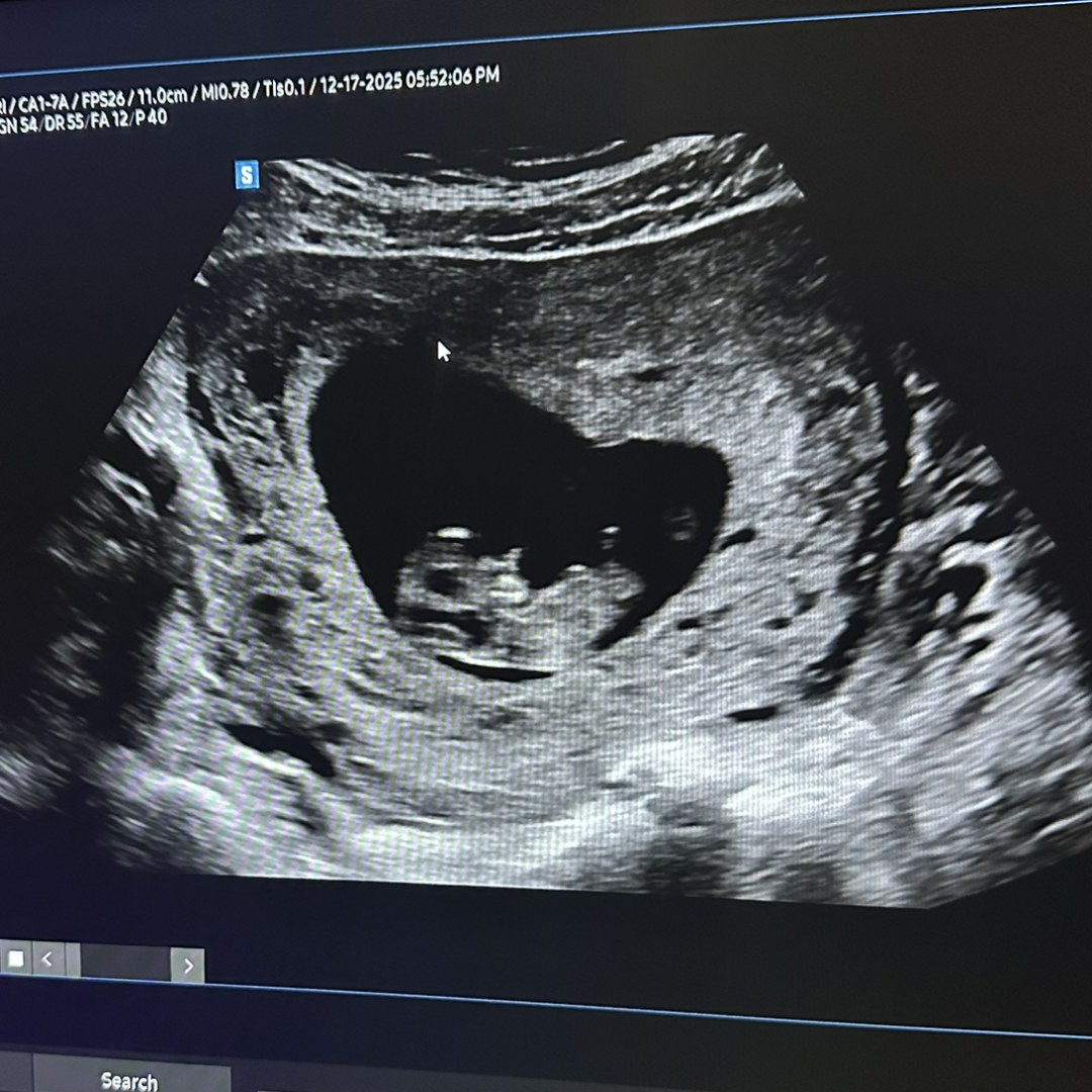 Photo shared by Alejandra for their Babylist baby registry.