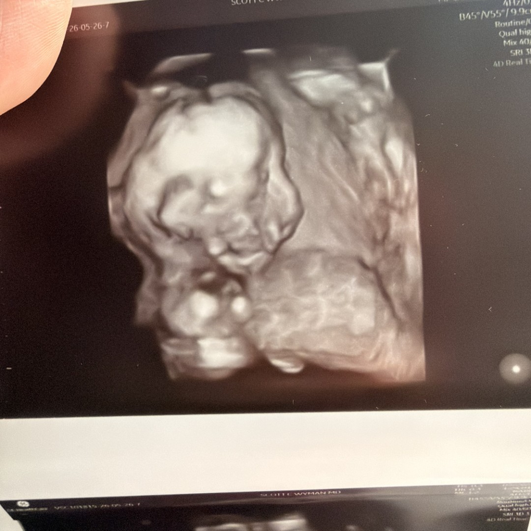 Photo shared by Mariah&Arlyn for their Babylist baby registry.