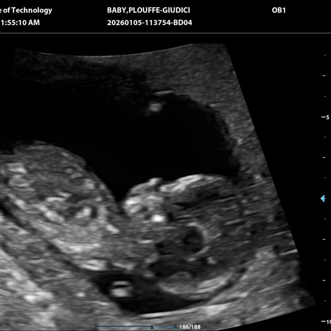 Photo shared by Therese for their Babylist baby registry.