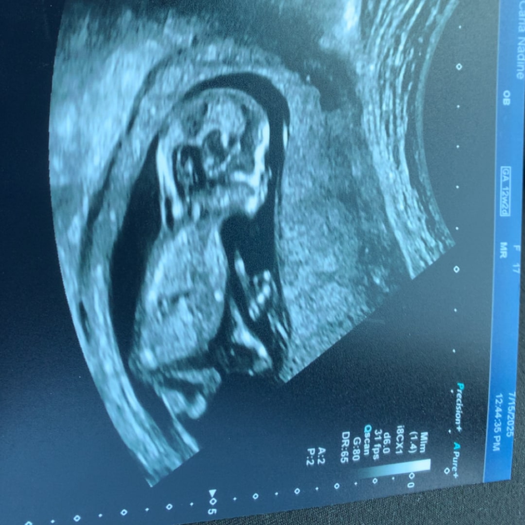 Photo shared by Carla for their Babylist baby registry.