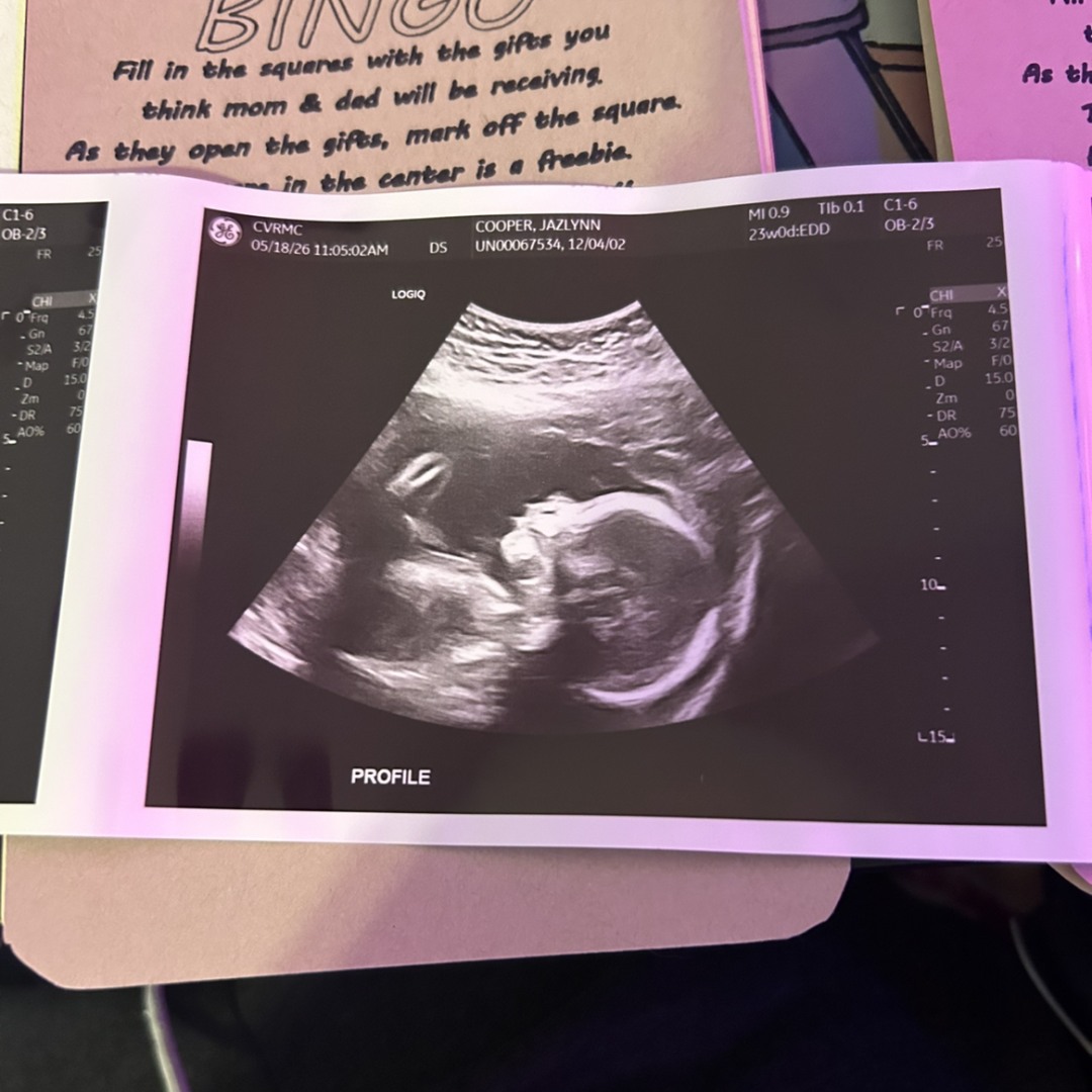 Photo shared by Jazlynn for their Babylist baby registry.