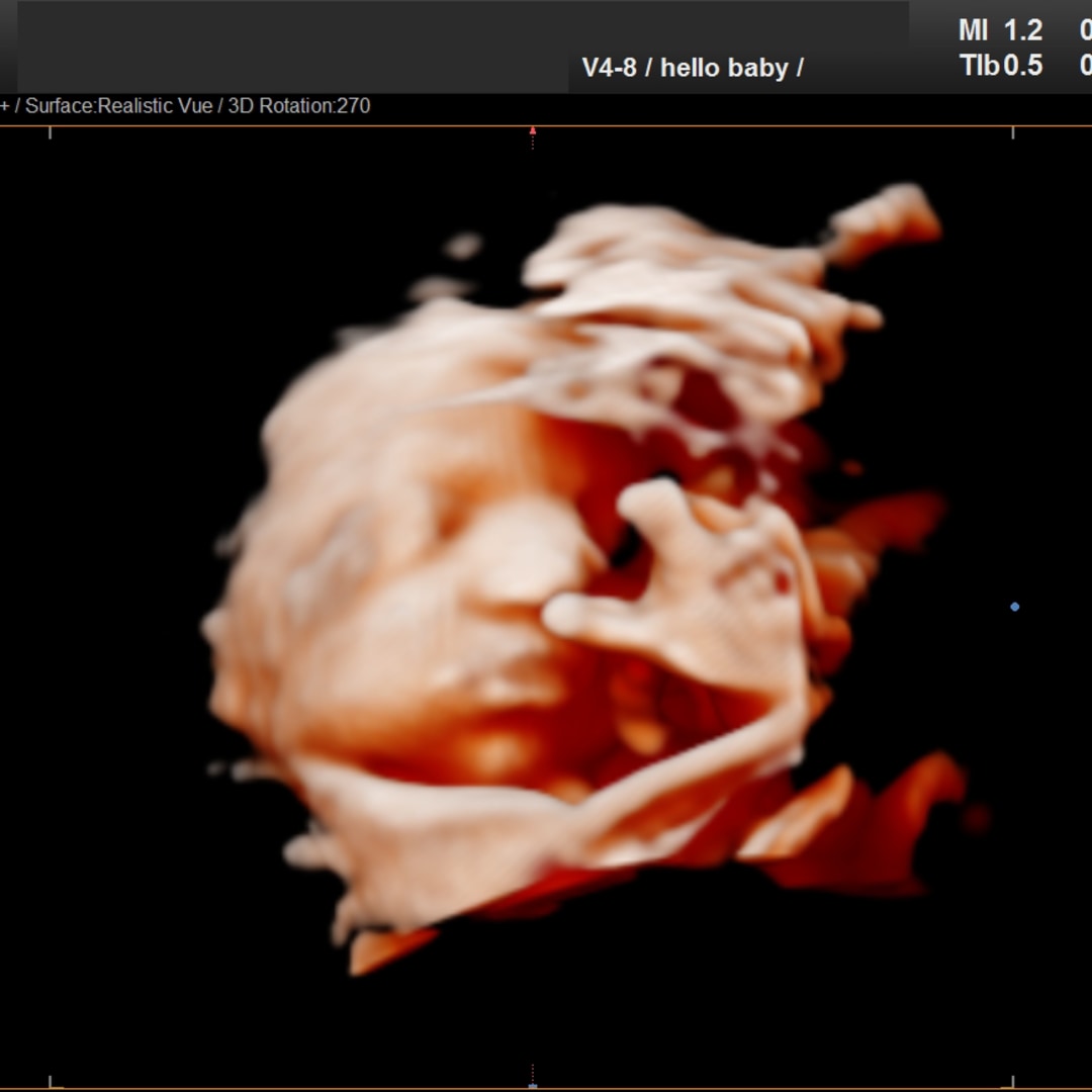 Photo shared by Diana for their Babylist baby registry.