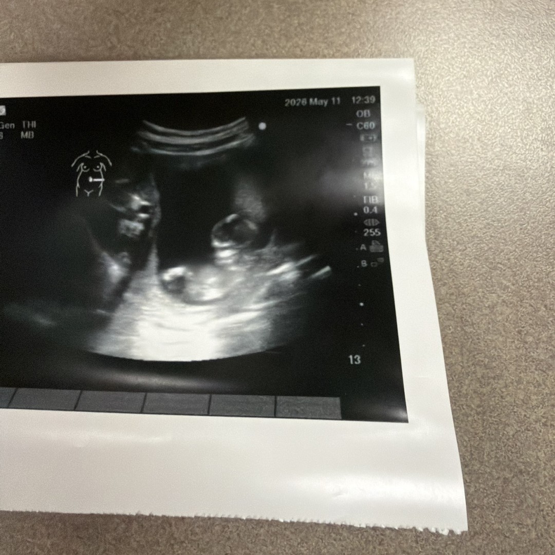 Photo shared by Ellisa for their Babylist baby registry.