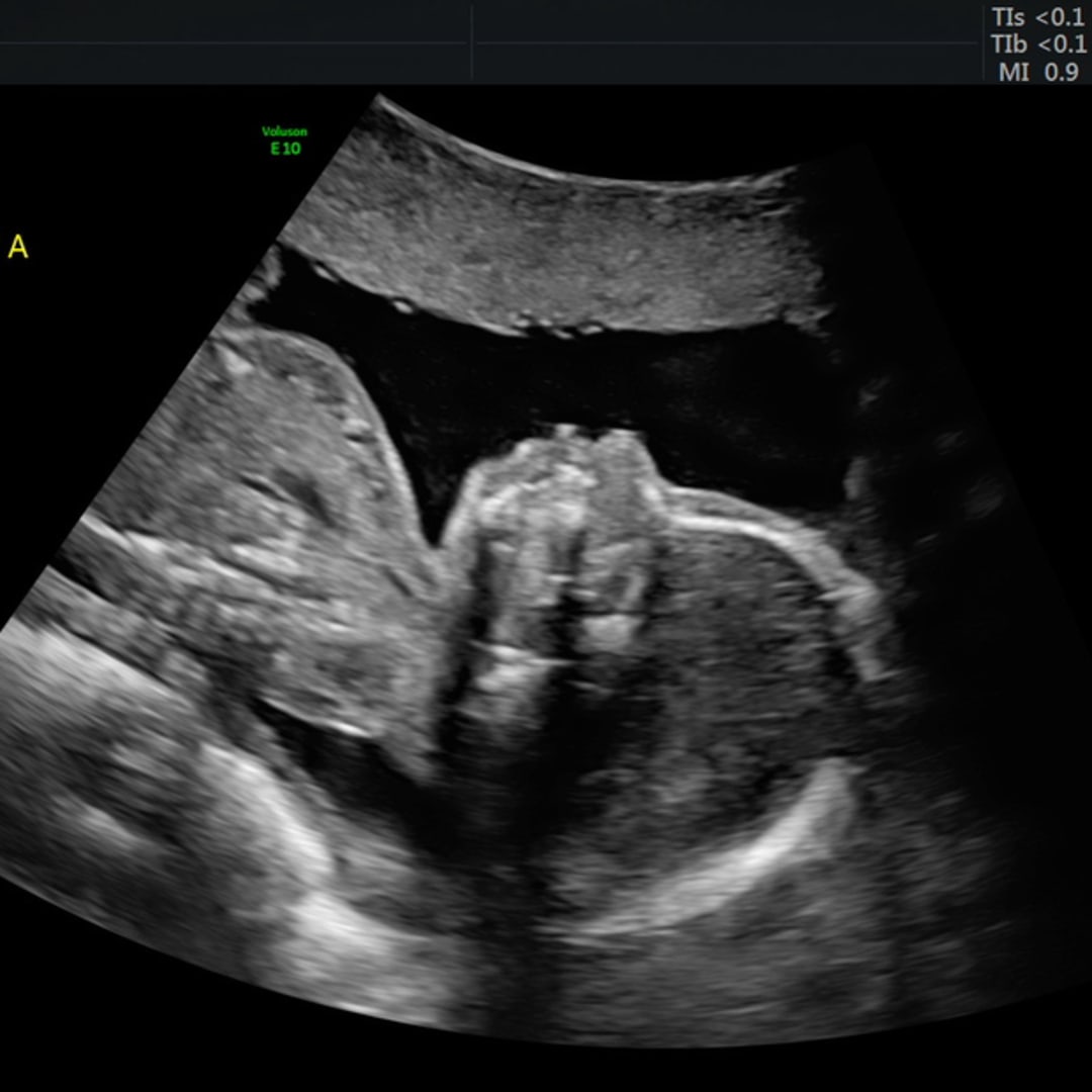 Photo shared by Alexa for their Babylist baby registry.