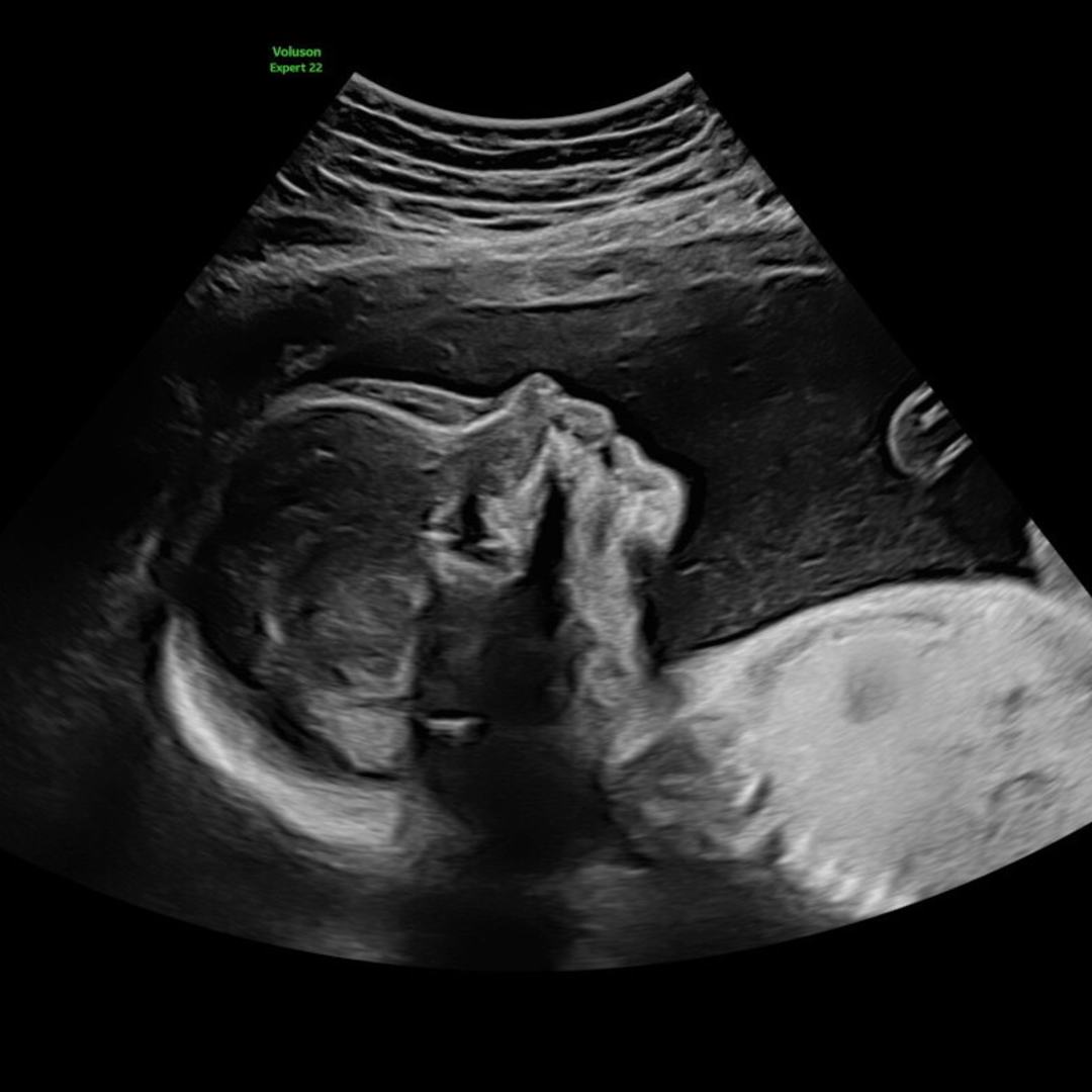 Photo shared by Sarah for their Babylist baby registry.