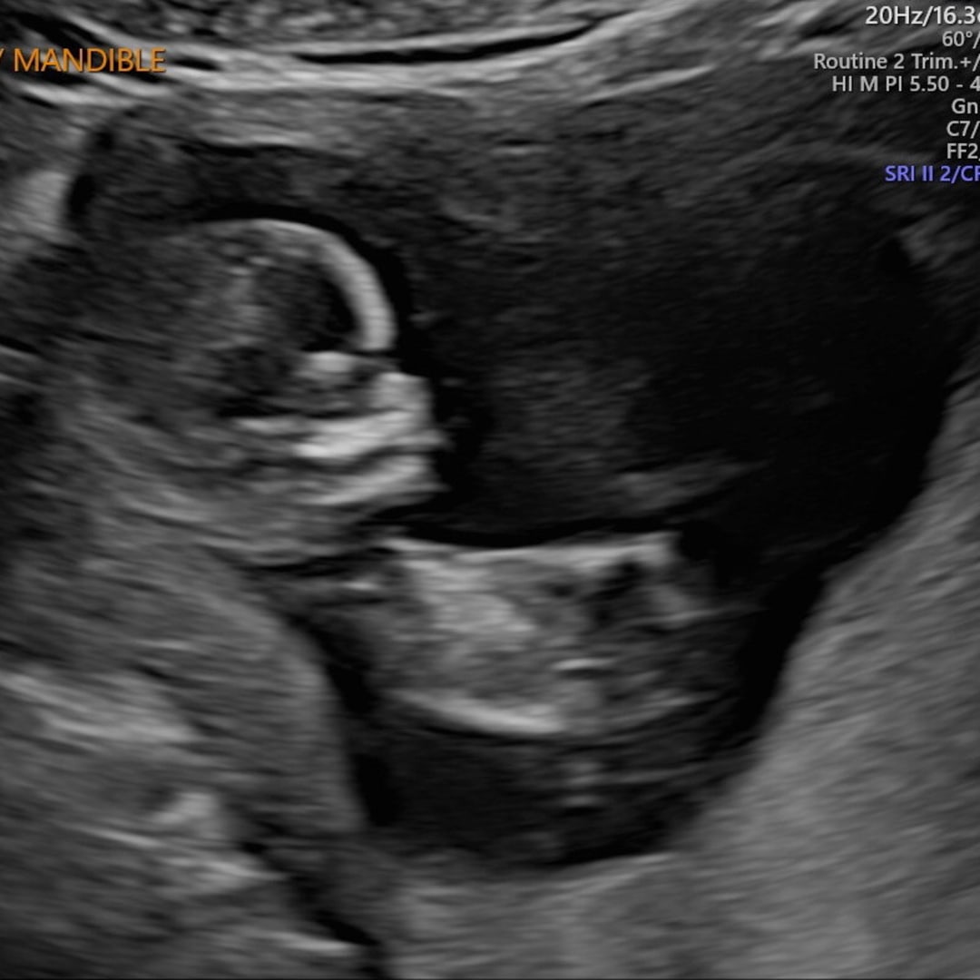 Photo shared by Mercedes for their Babylist baby registry.