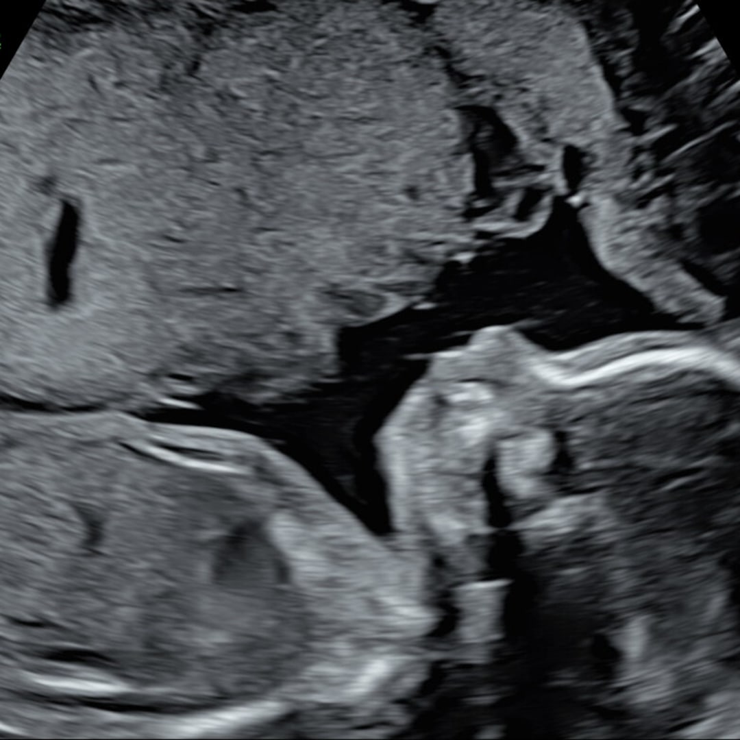 Photo shared by Amanda for their Babylist baby registry.