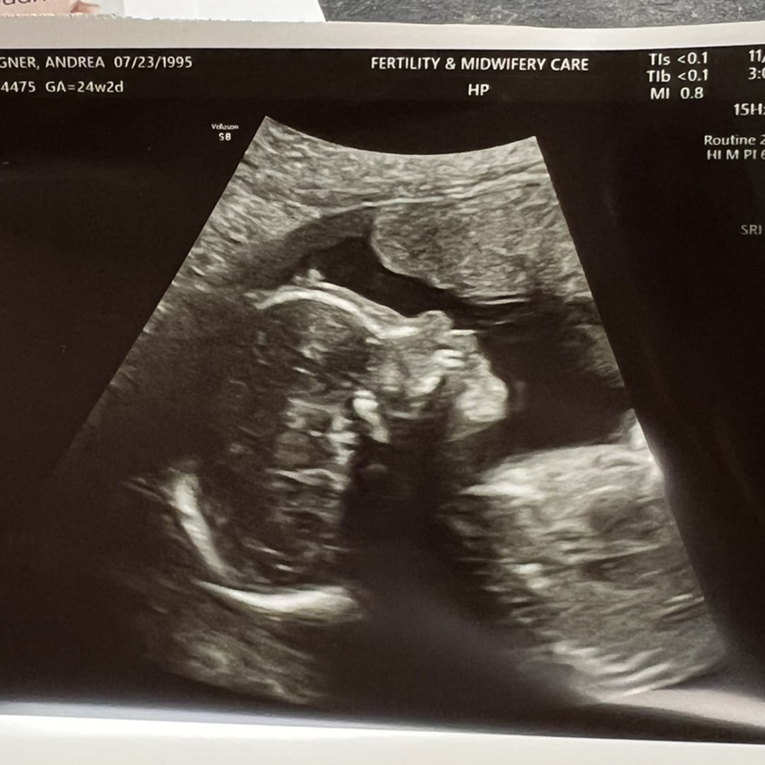 Photo shared by Andrea for their Babylist baby registry.