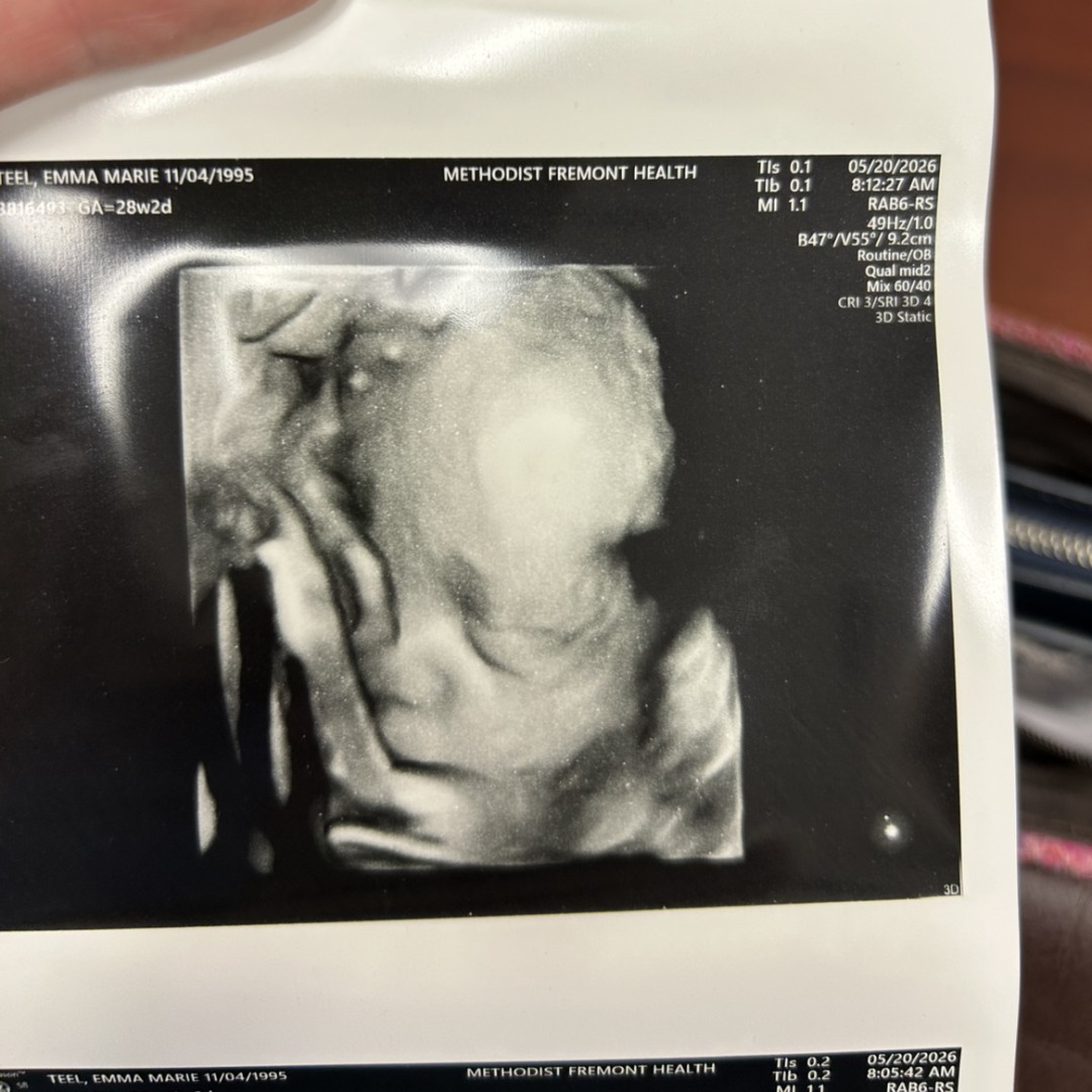 Photo shared by Emma for their Babylist baby registry.