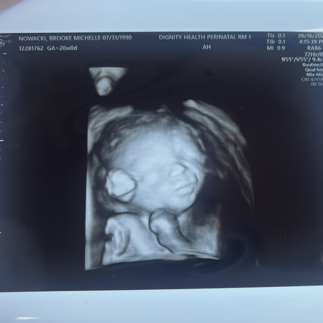 Photo shared by Brooke for their Babylist baby registry.