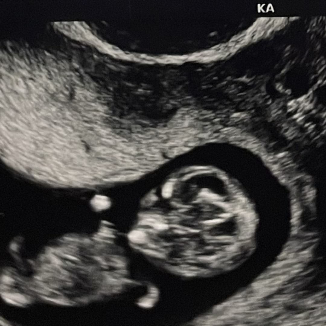 Photo shared by Hannah for their Babylist baby registry.