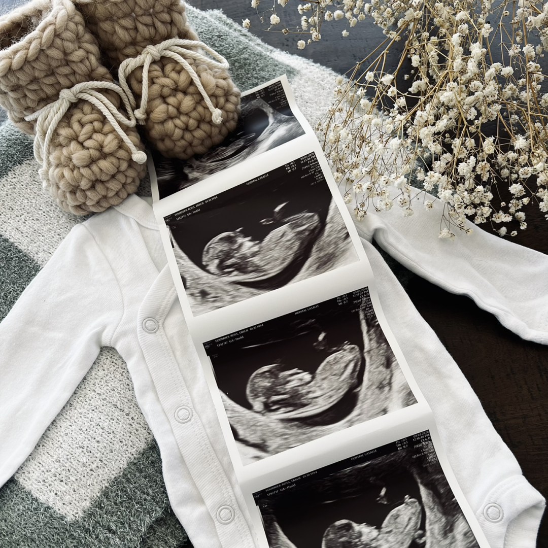 Photo shared by Emy for their Babylist baby registry.
