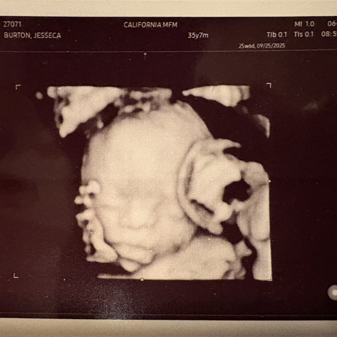 Photo shared by Jesseca for their Babylist baby registry.