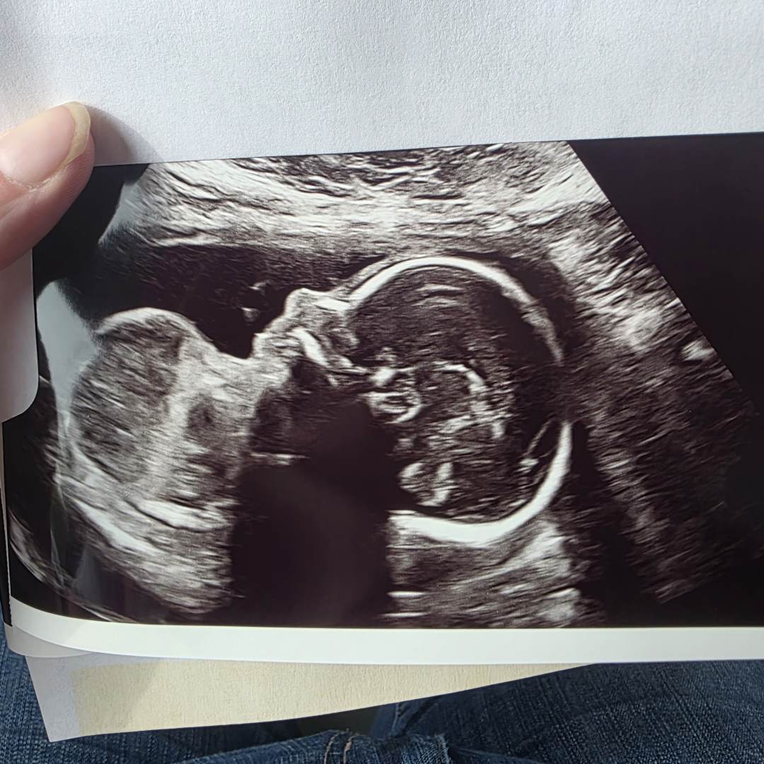 Photo shared by Shelsee for their Babylist baby registry.