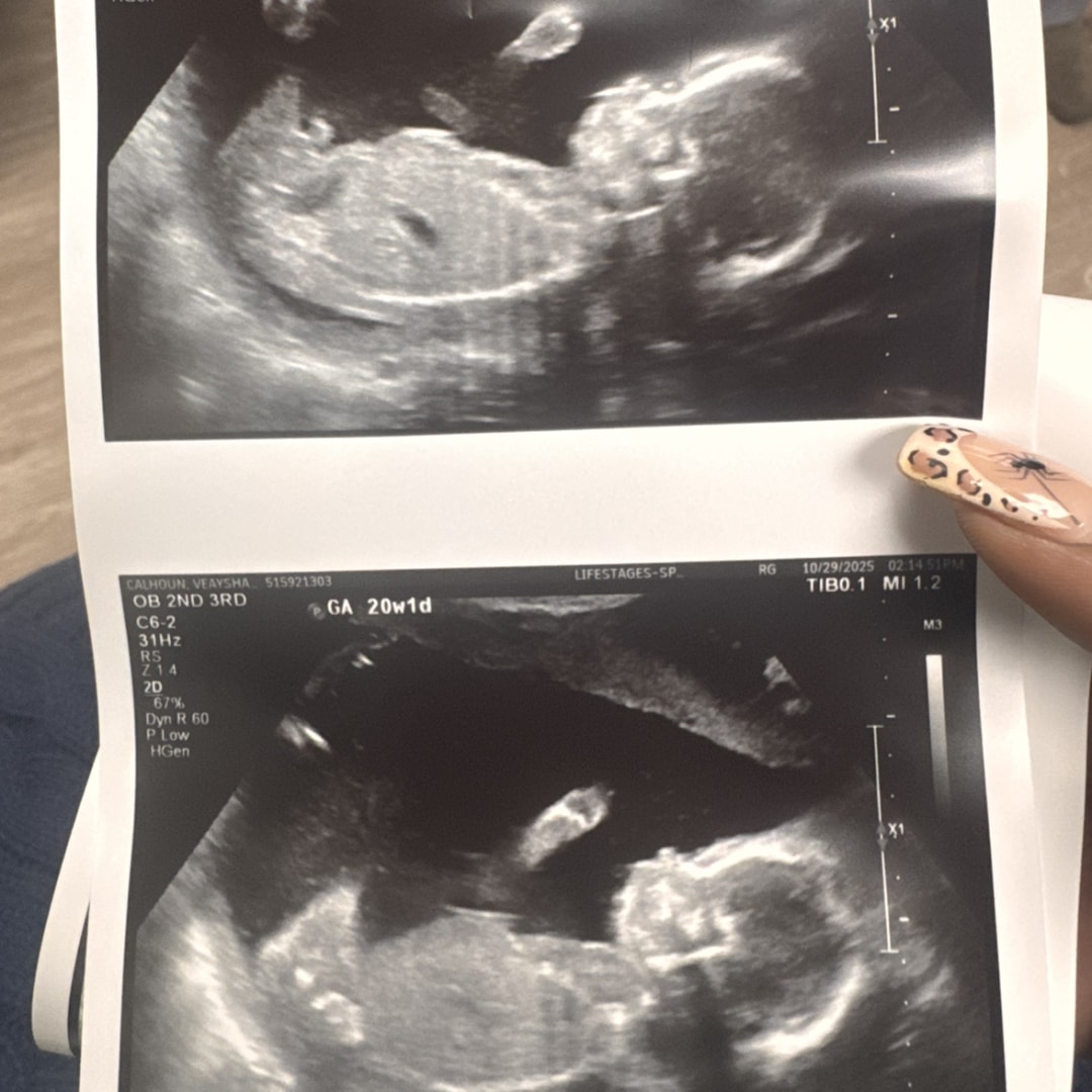 Photo shared by Aysha for their Babylist baby registry.