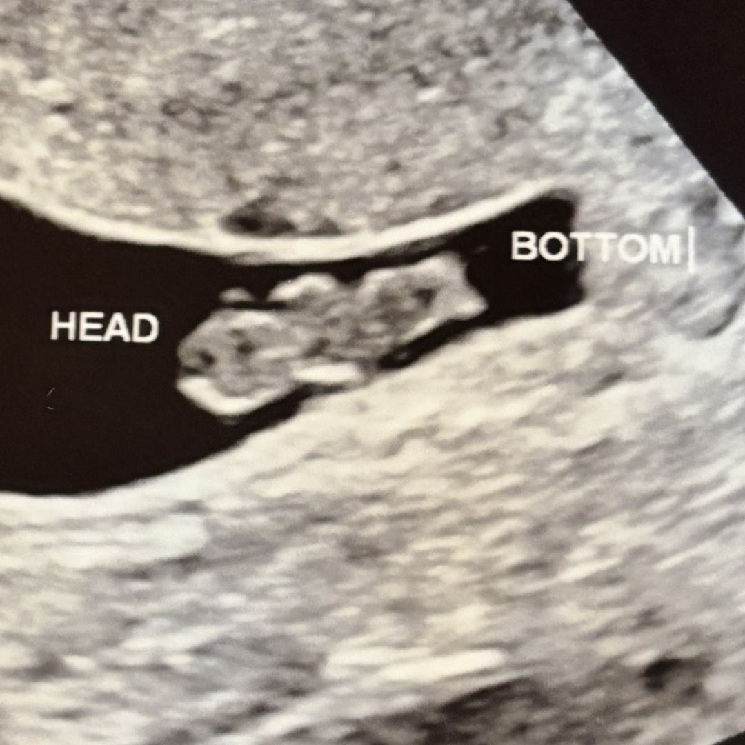 Photo shared by Ashley for their Babylist baby registry.