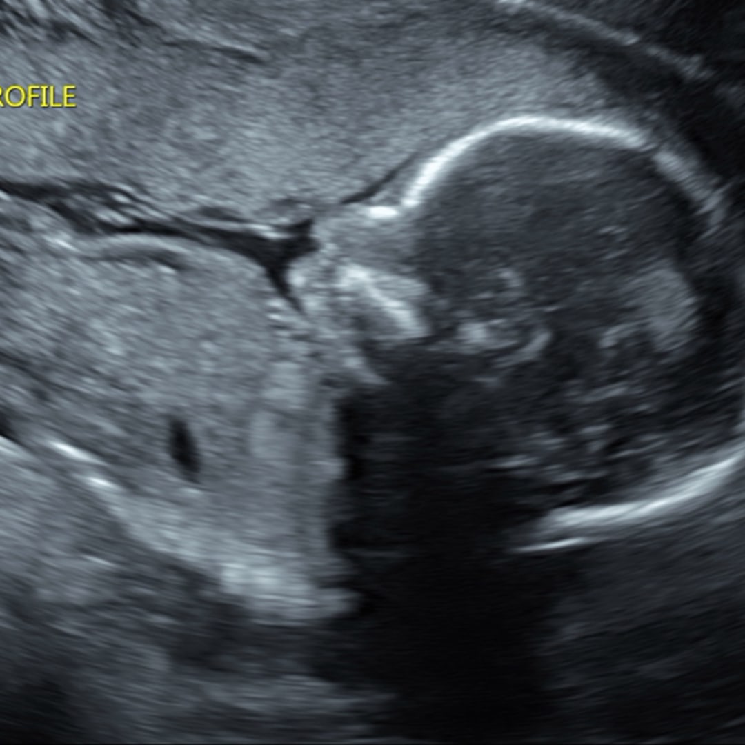 Photo shared by Joseph for their Babylist baby registry.