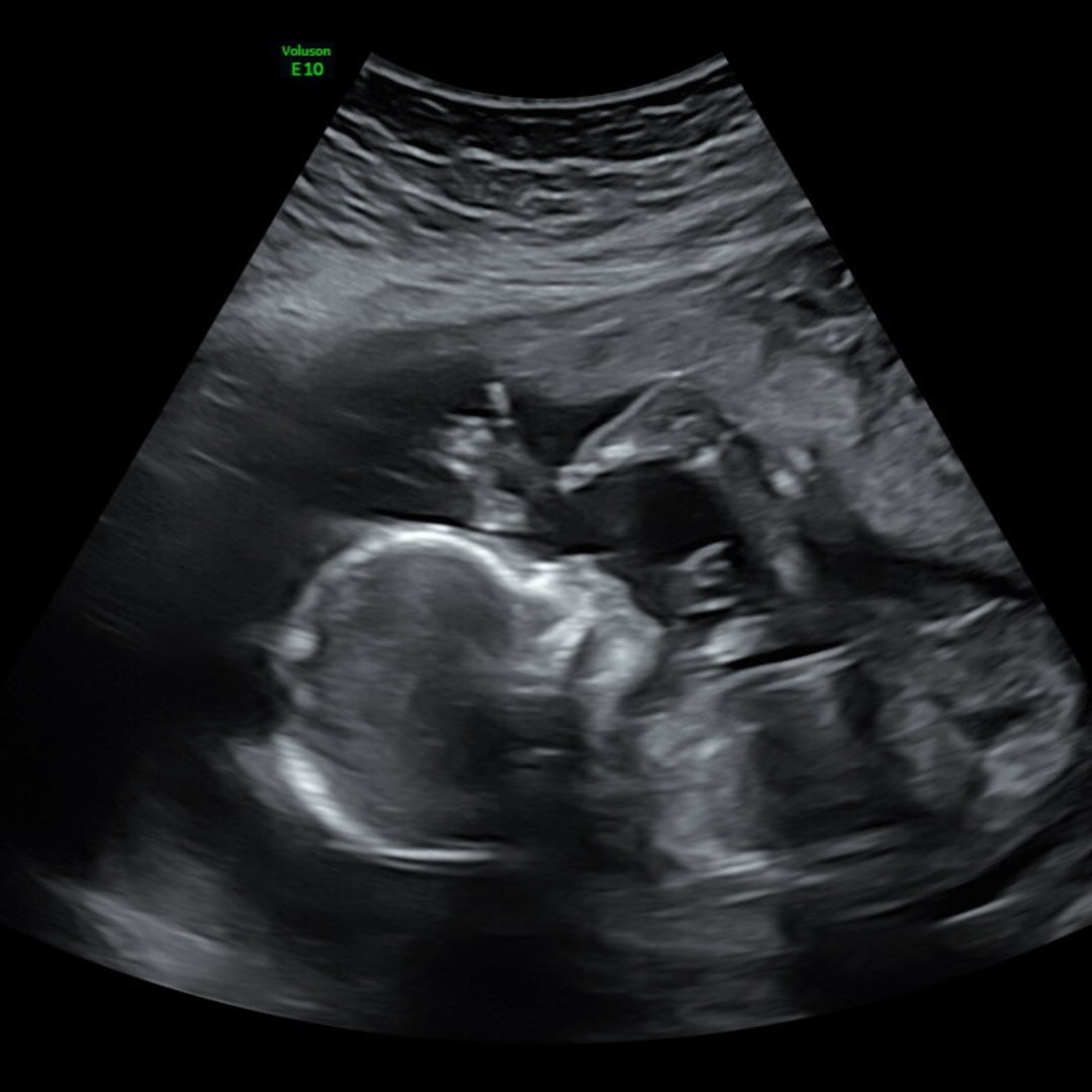 Photo shared by Fercy for their Babylist baby registry.