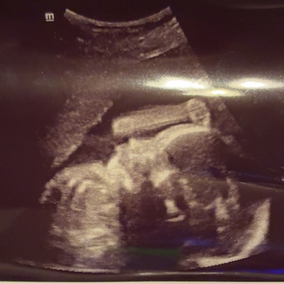 Photo shared by Leah for their Babylist baby registry.