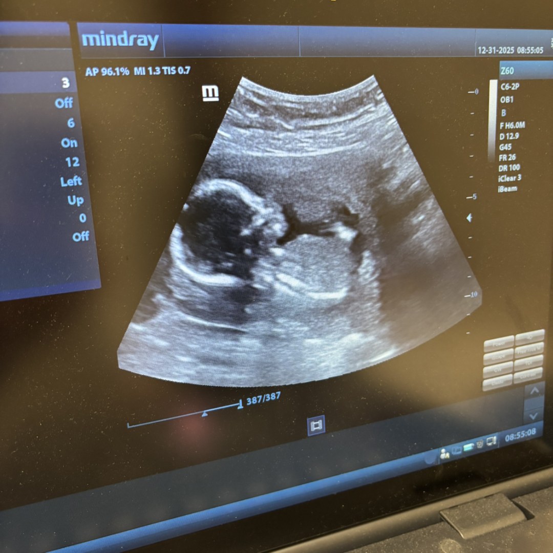 Photo shared by Brianna for their Babylist baby registry.