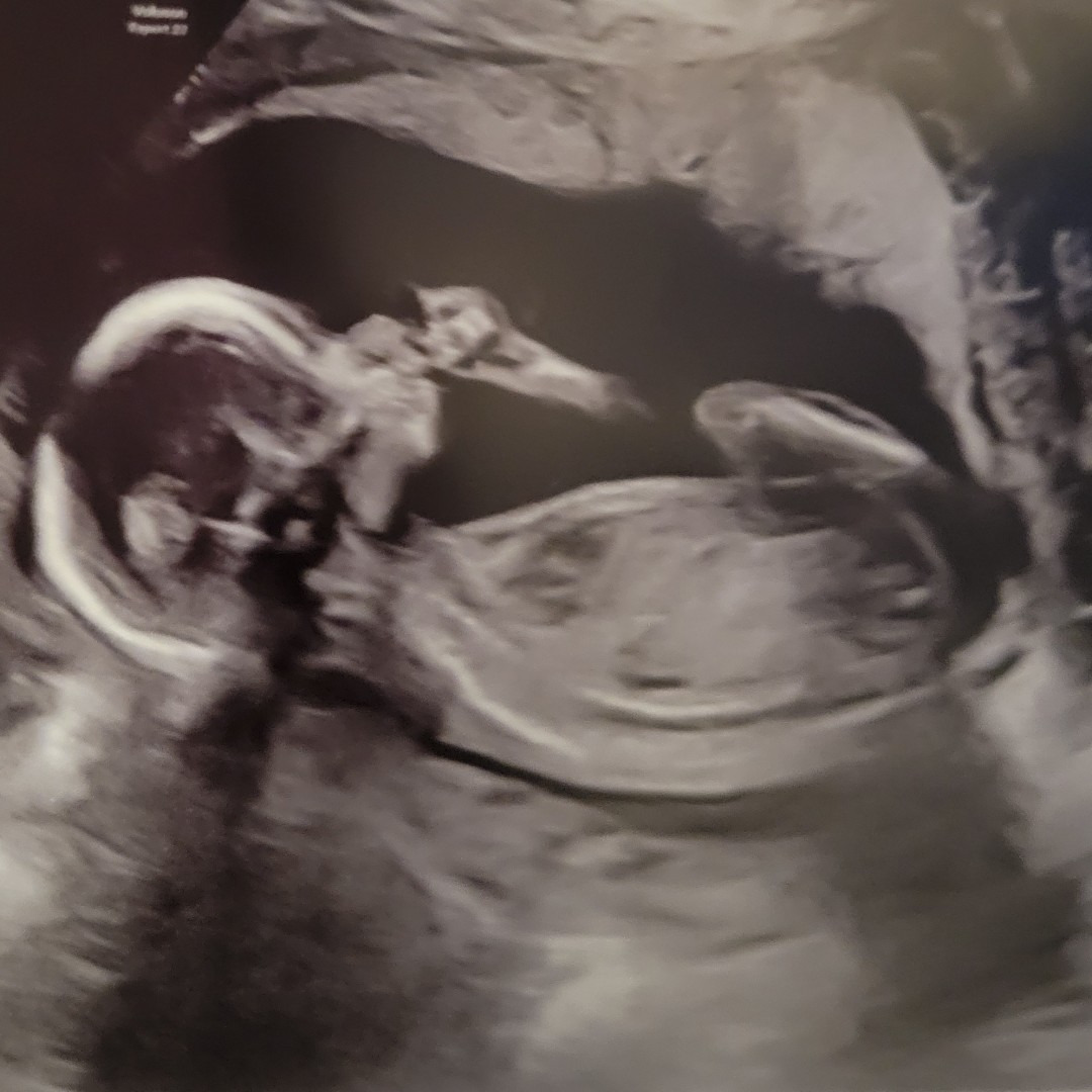 Photo shared by Robyn for their Babylist baby registry.