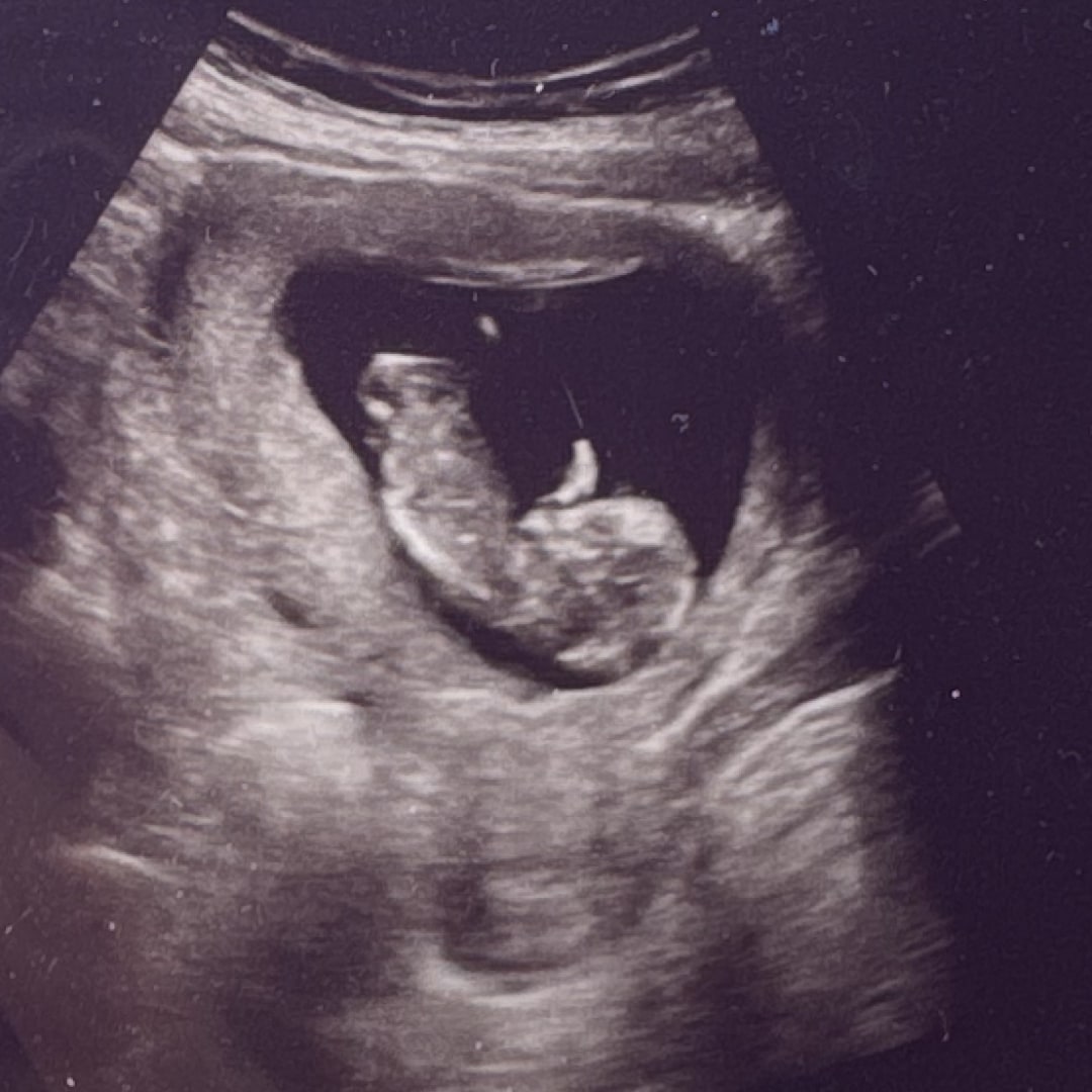 Photo shared by Emily for their Babylist baby registry.