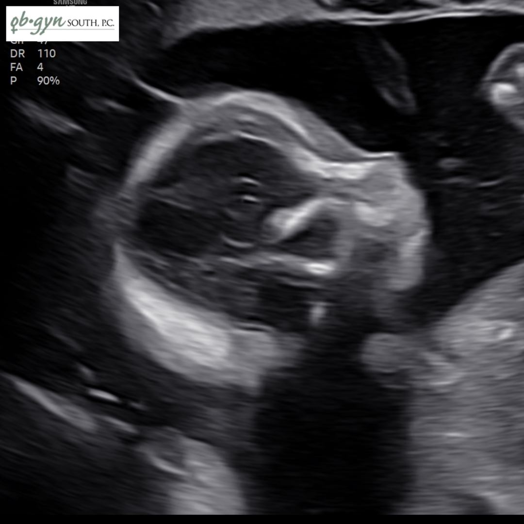 Photo shared by Katherine for their Babylist baby registry.
