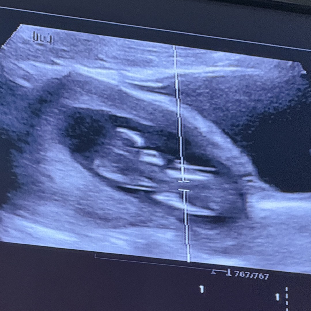 Photo shared by Maria for their Babylist baby registry.
