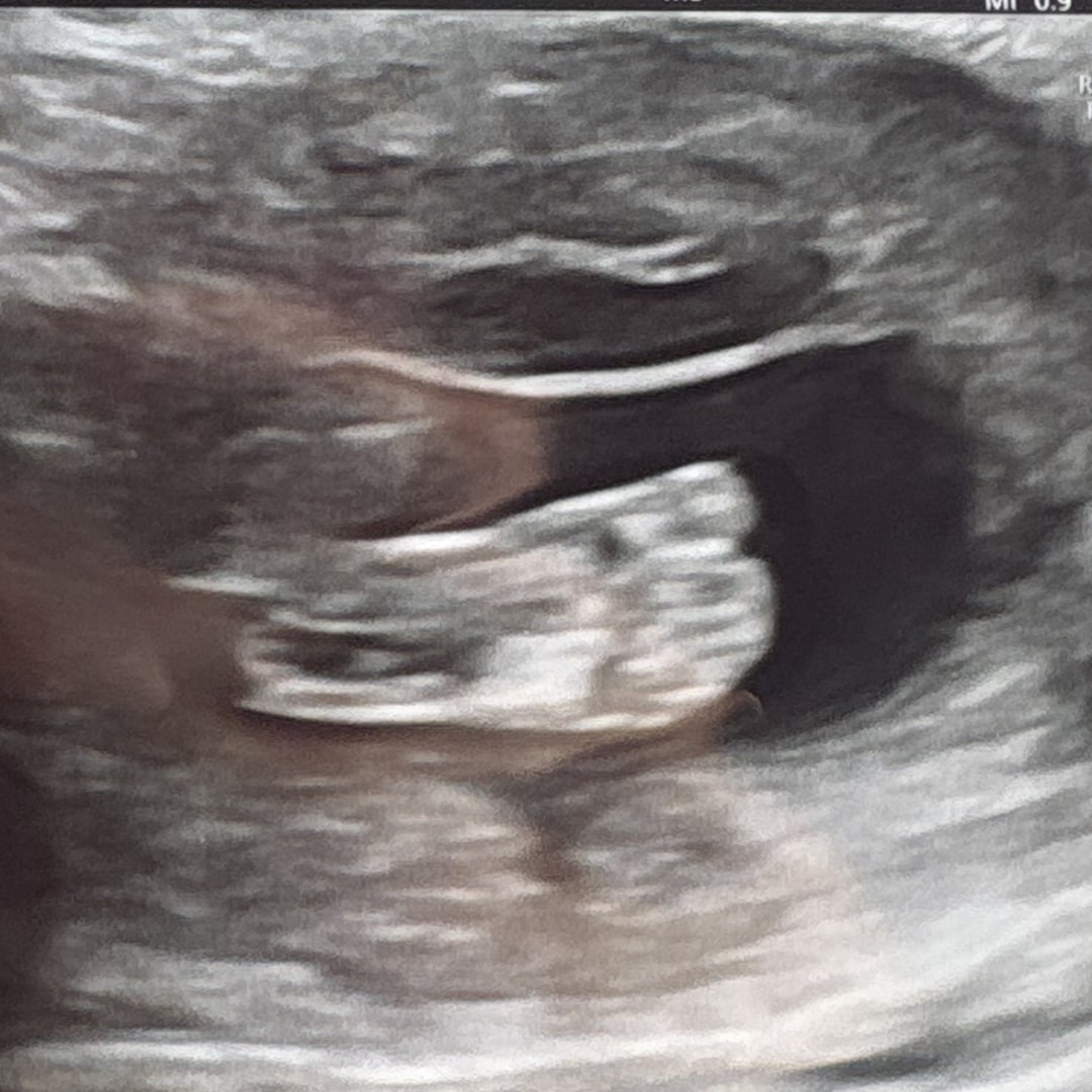 Photo shared by Marilee for their Babylist baby registry.