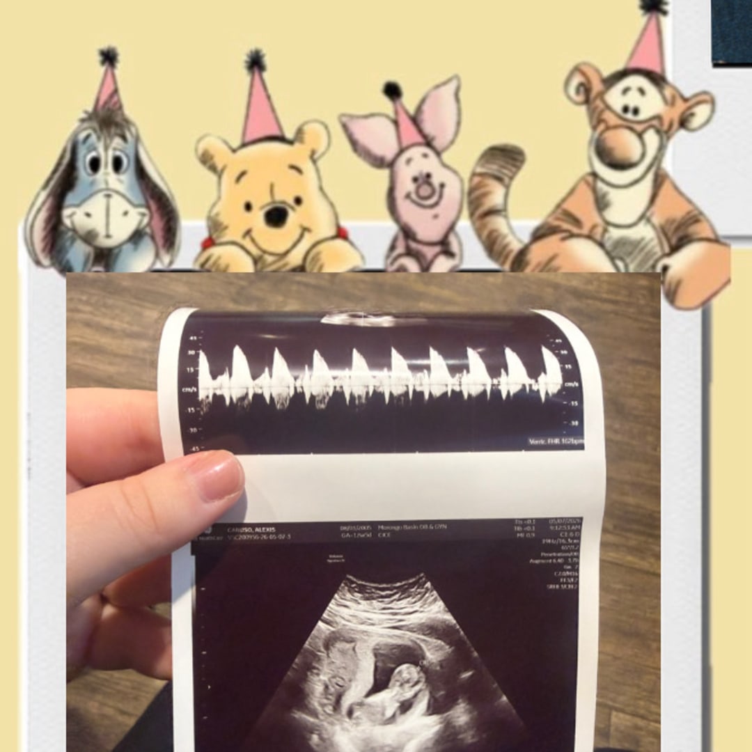 Photo shared by Alexis for their Babylist baby registry.