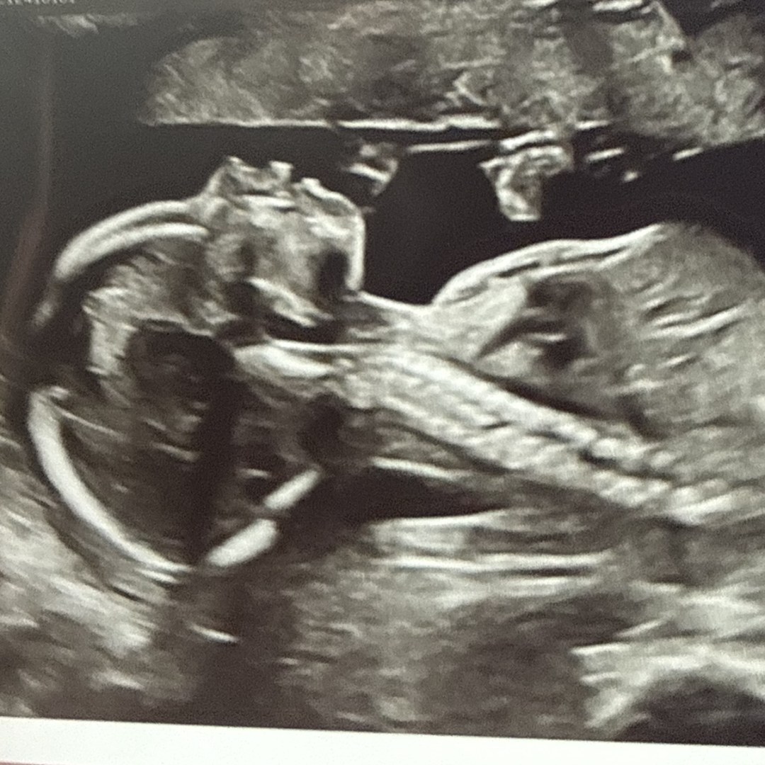 Photo shared by Cora for their Babylist baby registry.