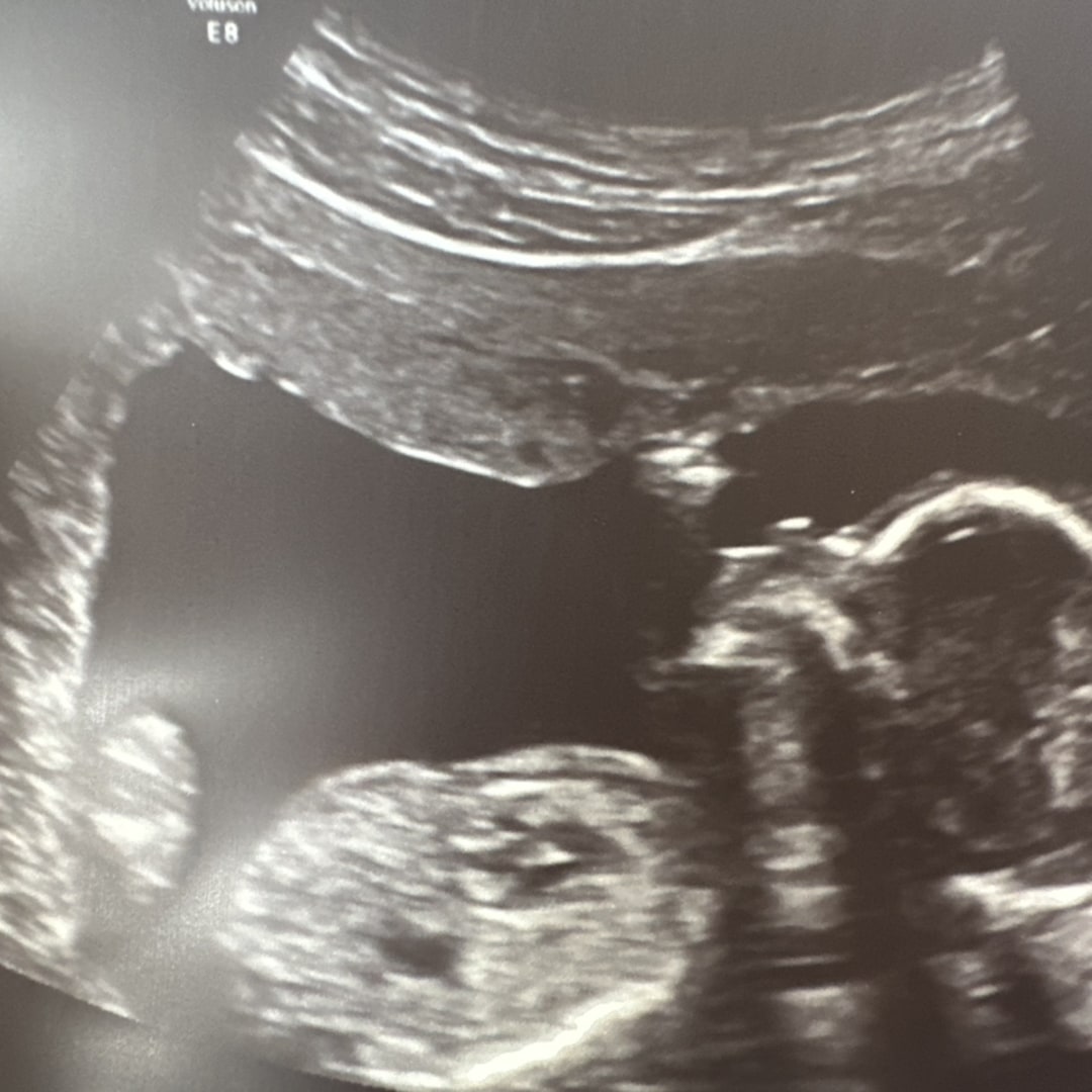 Photo shared by Destinye for their Babylist baby registry.
