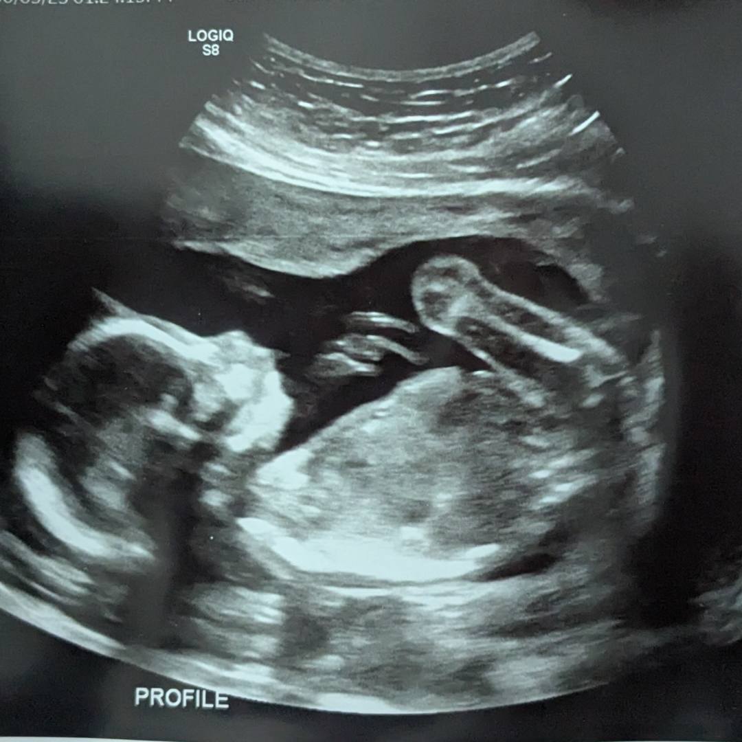 Photo shared by Carolyn for their Babylist baby registry.