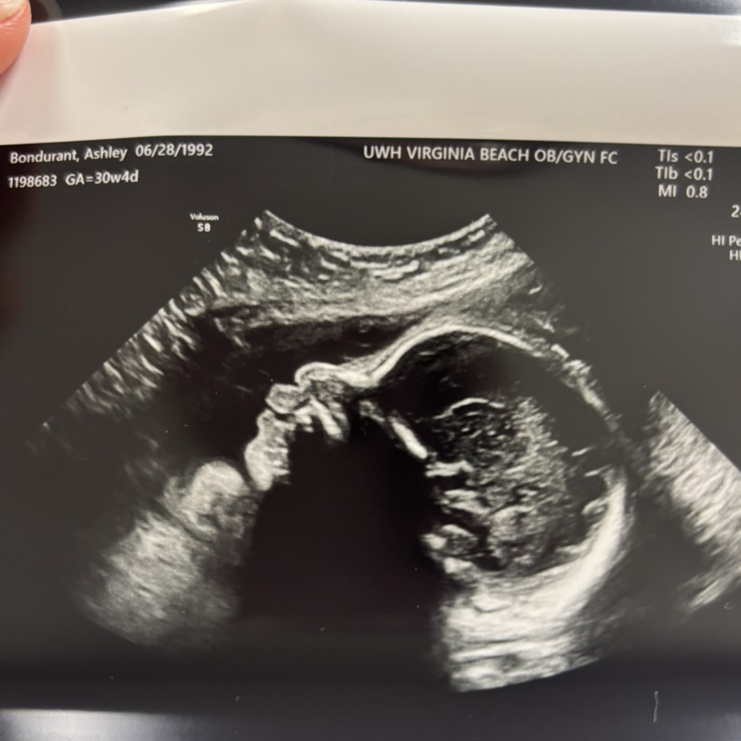 Photo shared by Ashley for their Babylist baby registry.