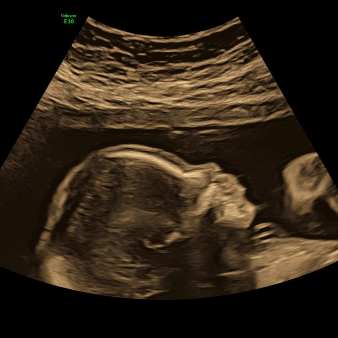 BABYL VIPパス&ミニ写真集セット 2015年ワールドツアー Monique and Leandro Ortiz's Baby Registry at Babylist