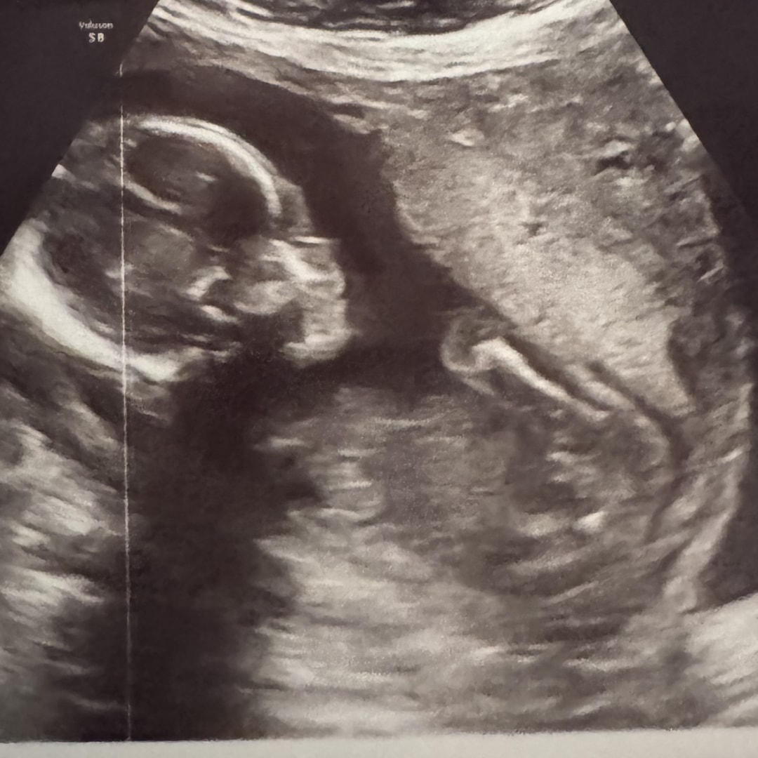 Photo shared by Brianna for their Babylist baby registry.