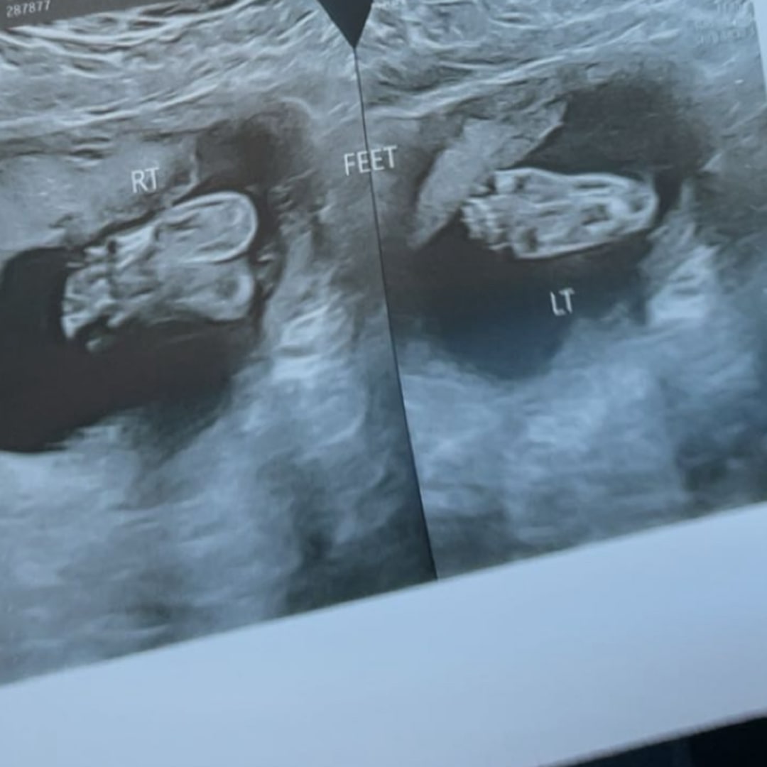 Photo shared by Madison for their Babylist baby registry.