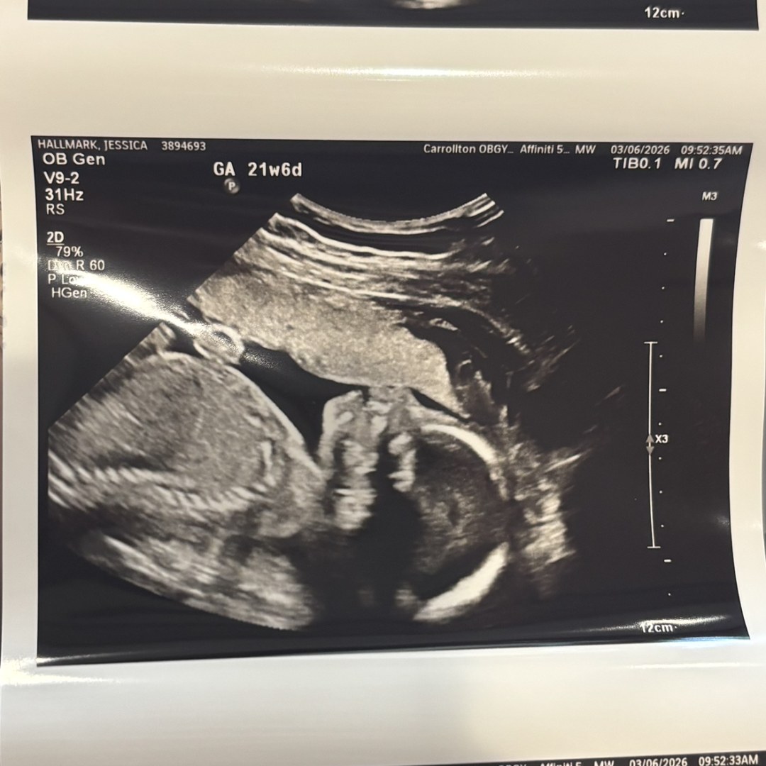 Photo shared by Jessie for their Babylist baby registry.