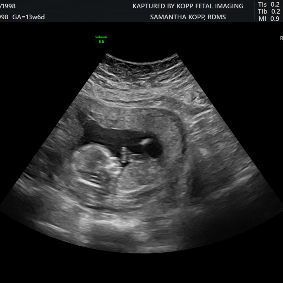 Photo shared by Balee for their Babylist baby registry.
