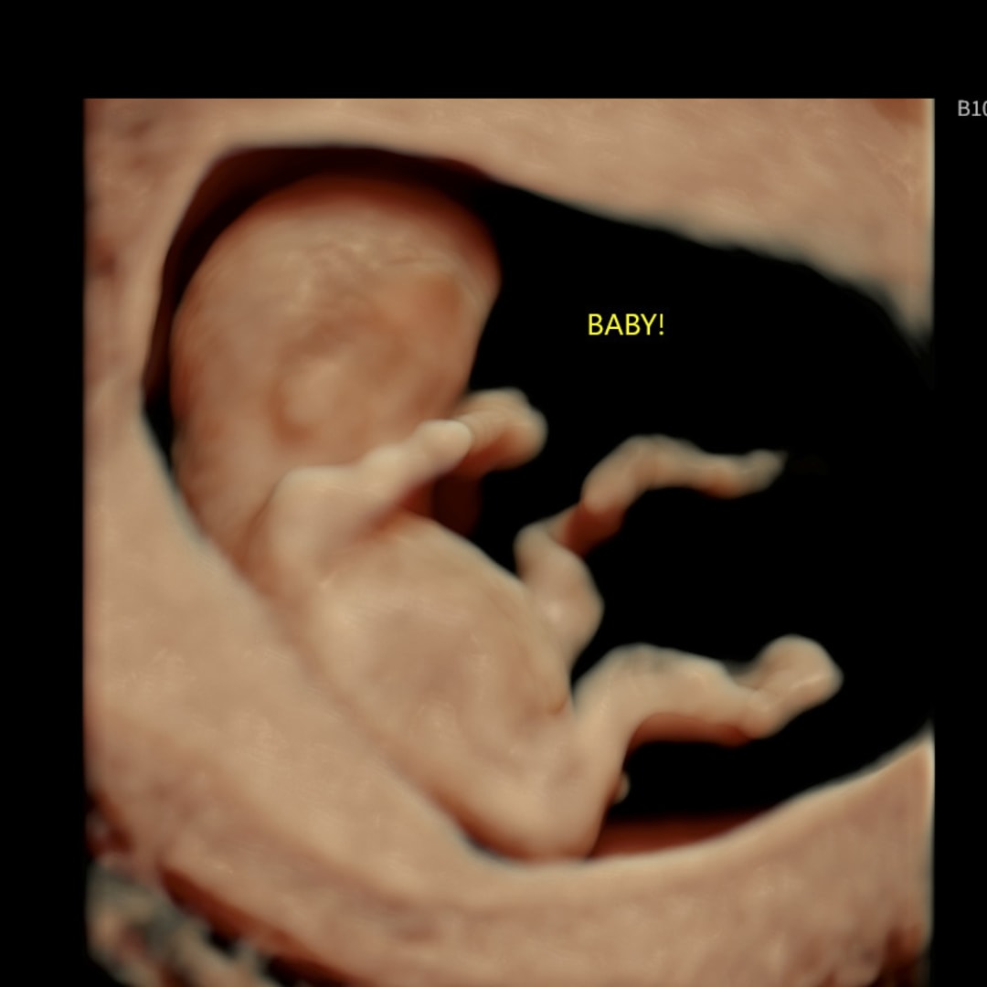 Photo shared by Sarah for their Babylist baby registry.