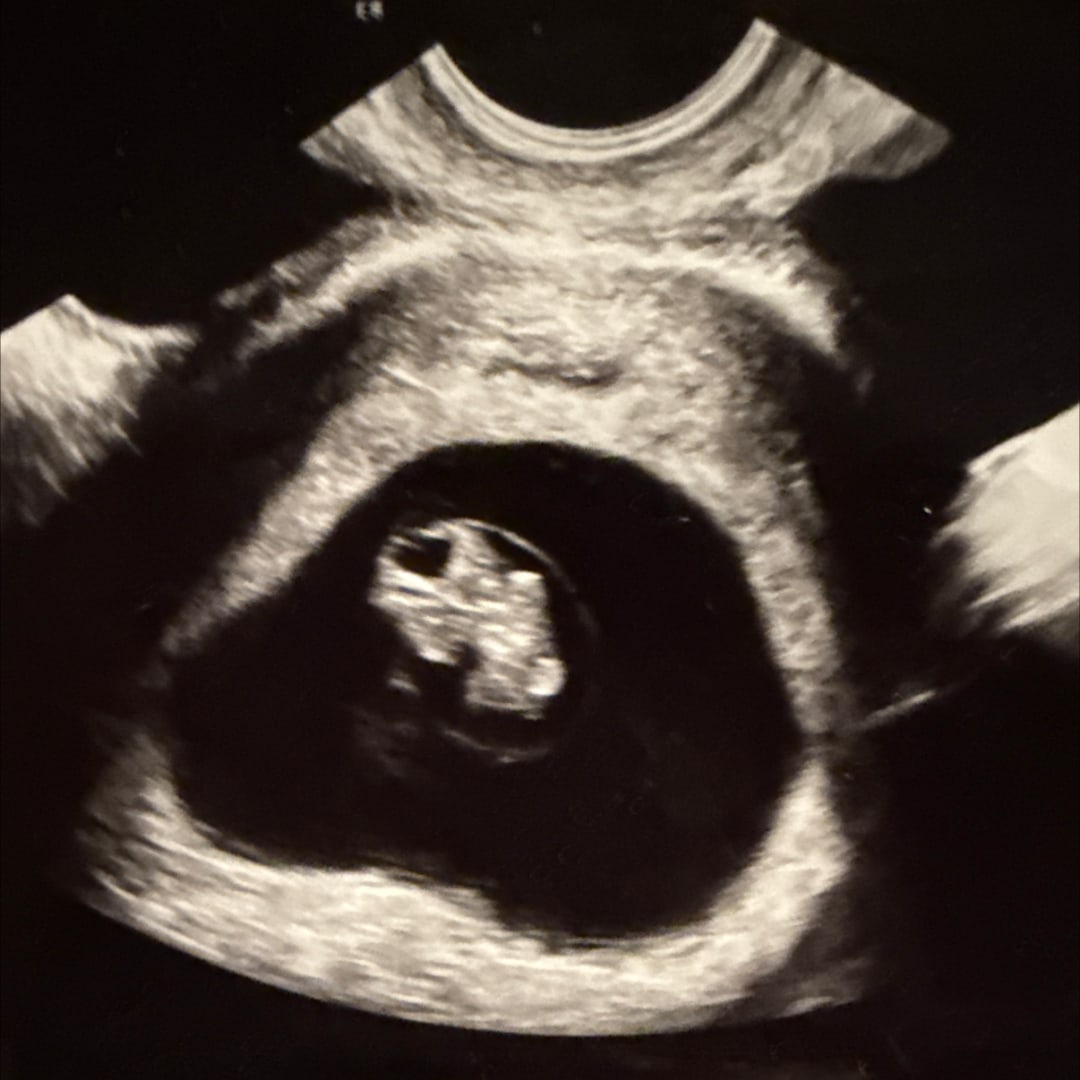 Photo shared by Daniela for their Babylist baby registry.