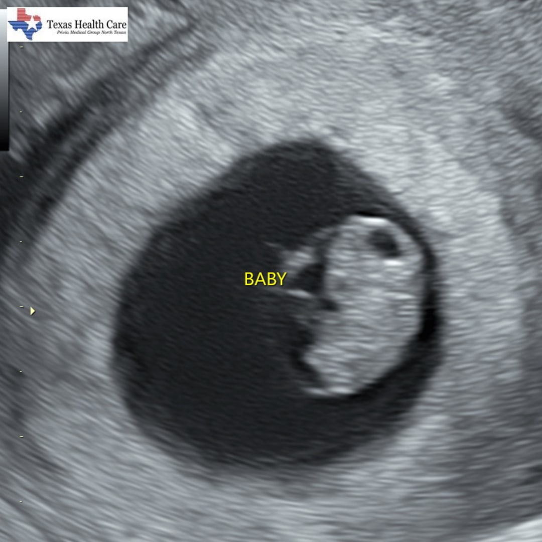 Photo shared by Bailey for their Babylist baby registry.